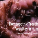 Homeopathic Treatment for Parasites in Humans?